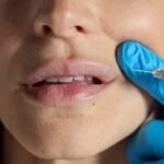 AI tool put to test sifting public views on botox and fillers